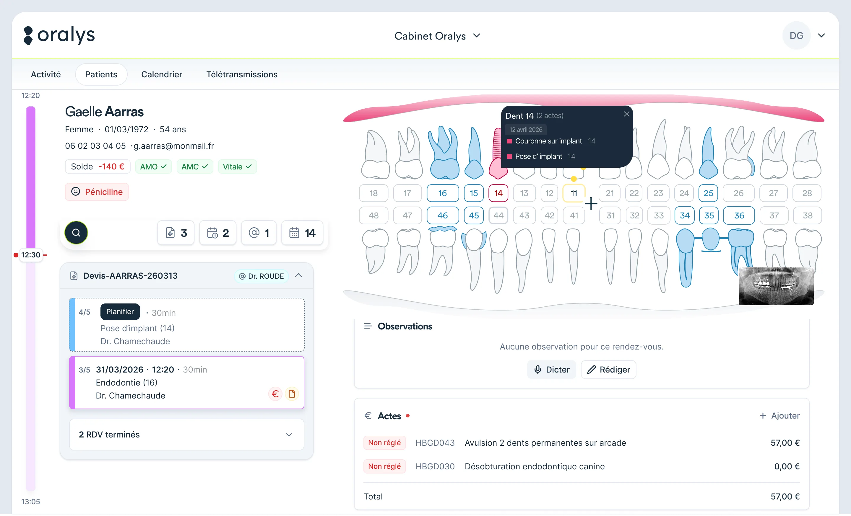 Aperçu de l'interface Oralys — Fiche patient